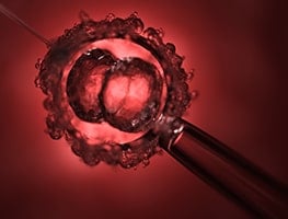 Embryo transfer microscopic image