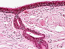 Microscopic image after ovulating